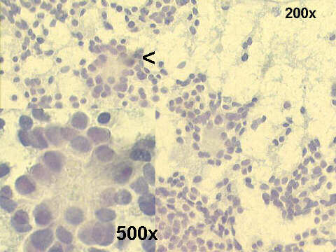 200x and 500x Papanicolaou staining