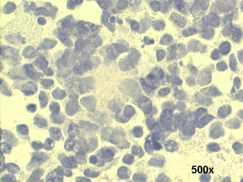 500x Papanicolaou staining