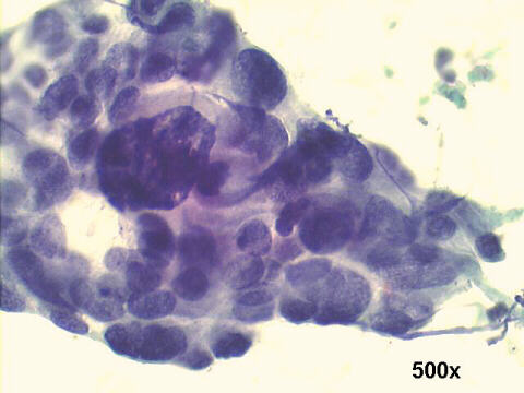 500x Papanicolaou staining