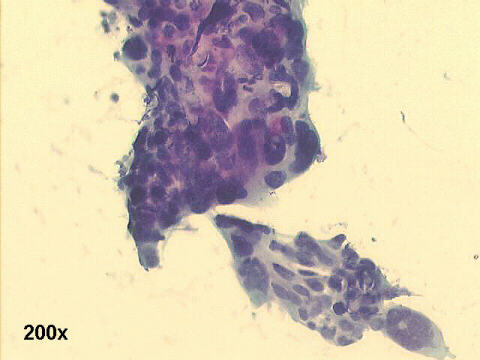 200x Papanicolaou staining