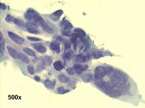  500x Papanicolaou staining, enlarged view of previous image