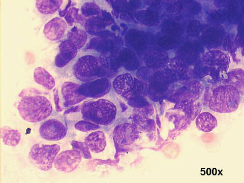 500x M-G-G staining