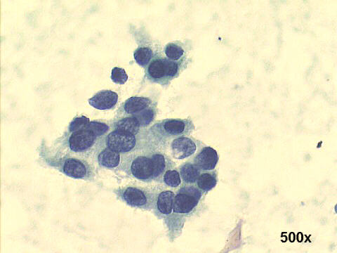 500x Papanicolaou staining