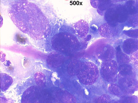 500x M-G-G staining