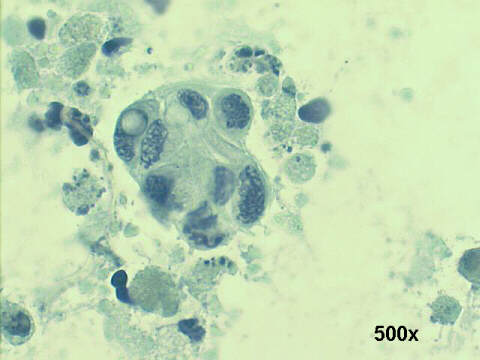 500x Papanicolaou staining