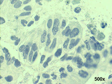 500x Papanicolaou staining