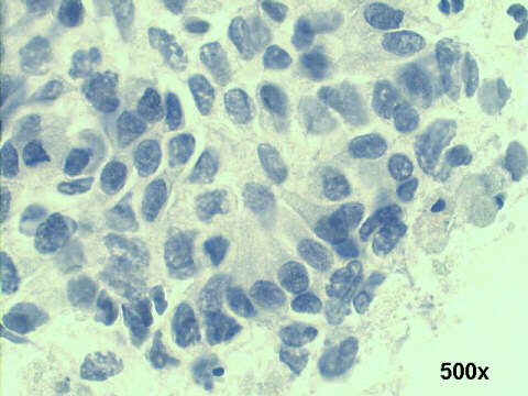 500x Papanicolaou staining