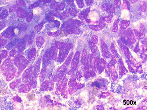 500x M-G-G staining
