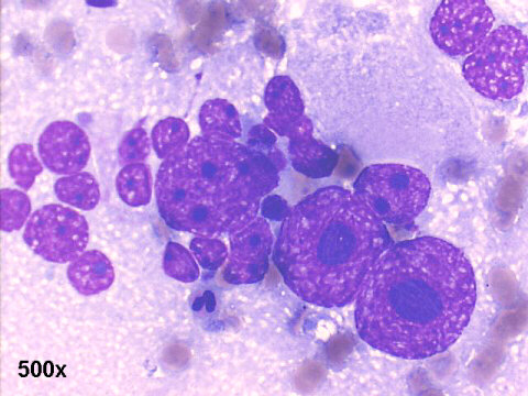 500x, M-G-G staining