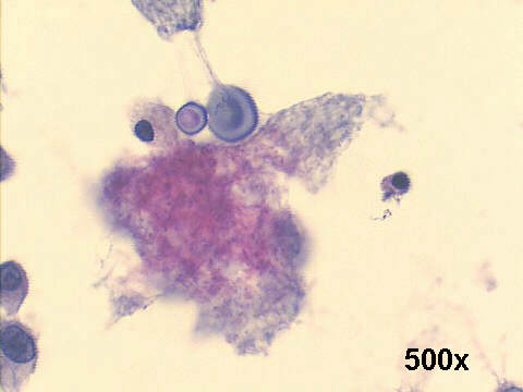 500x Papanicolaou staining