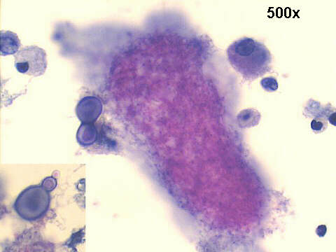 500x Papanicolaou staining