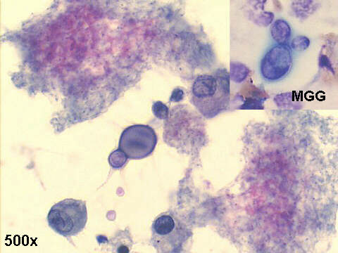 500x Papanicolaou and M-G-G staining (insert)