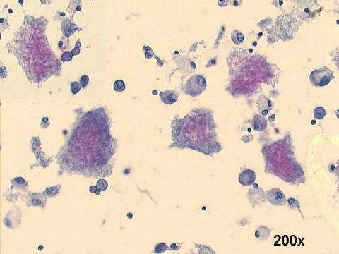 200x Papanicolaou staining