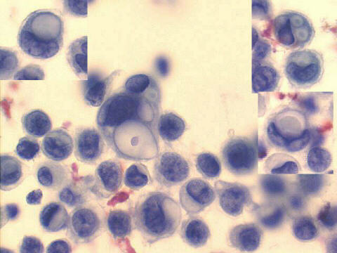 500x Papanicolaou staining