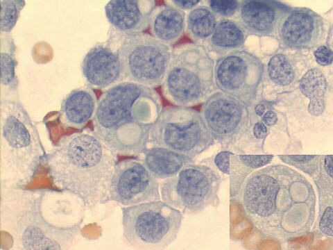 500x Papanicolaou staining