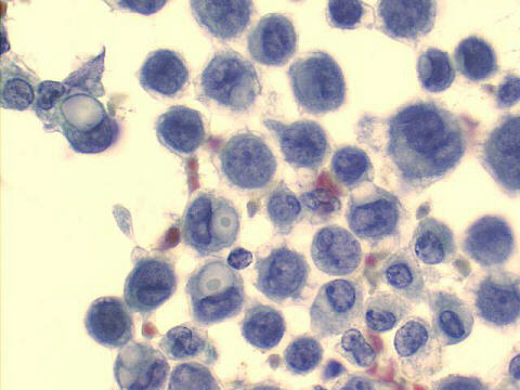 500x Papanicolaou staining