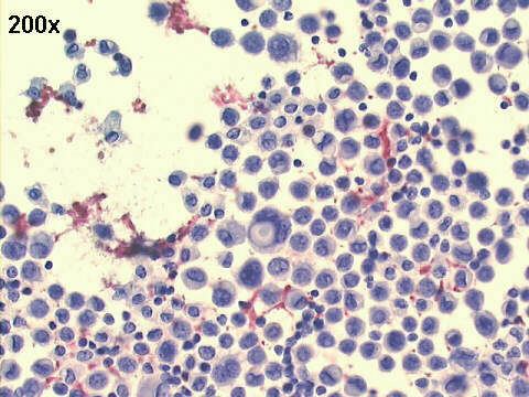 200x oil Papanicolaou staining