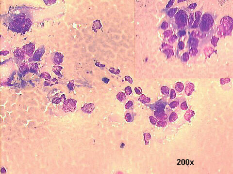 200x M-G-G staining, 20x oil objective lens