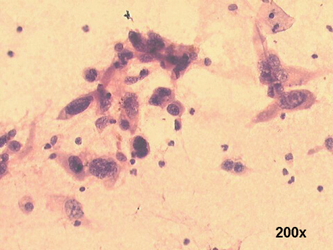 200x Papanicolaou staining