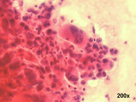 200x Papanicolaou staining