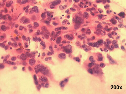 200x Papanicolaou staining
