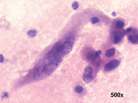500x Papanicolaou staining