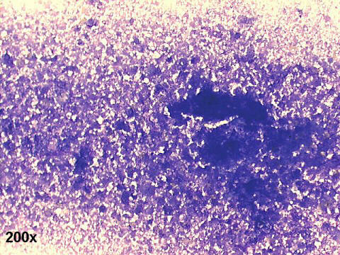 200x M-G-G staining