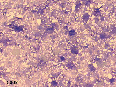 500x M-G-G staining