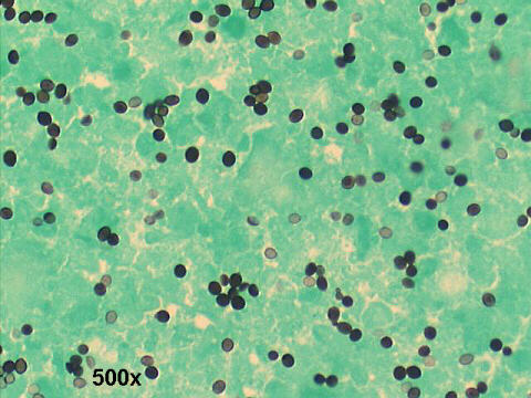 500x Gomori silver staining