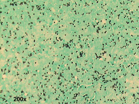 200x Gomori silver staining