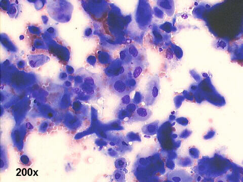 200x M-G-G  staining