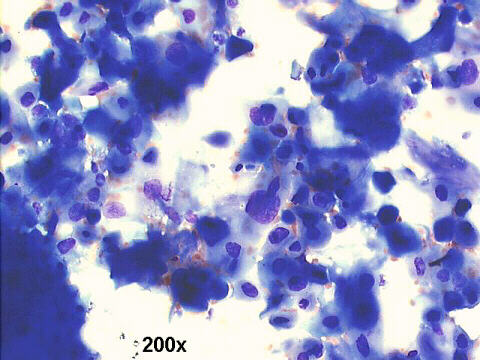 200x M-G-G  staining