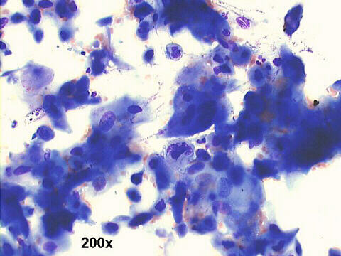 200x M-G-G  staining