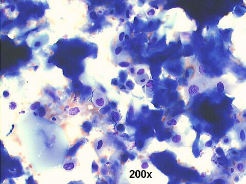 200x M-G-G  staining