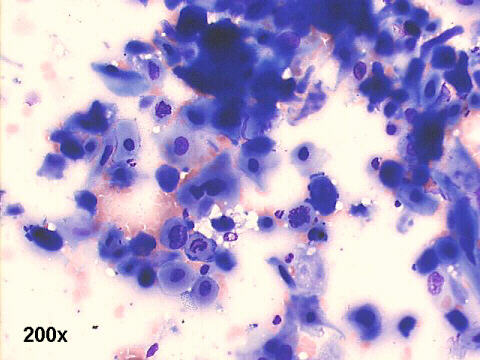 200x M-G-G  staining
