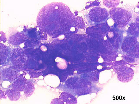 500x M-G-G staining