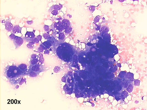 200x M-G-G  staining