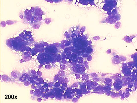 200x M-G-G  staining