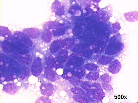 500x M-G-G staining