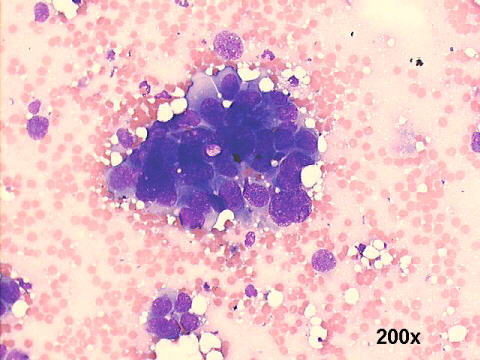 200x M-G-G  staining