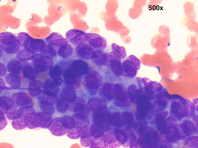 500x M-G-G staining