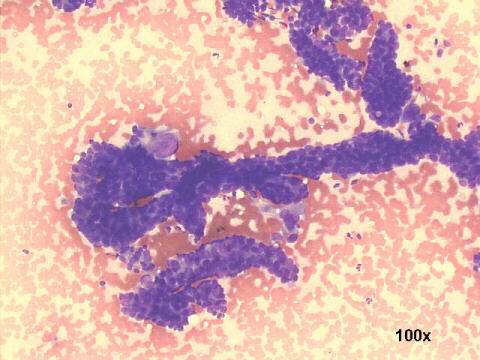 100x M-G-G staining