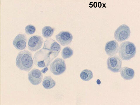 500x oil Papanicolaou staining