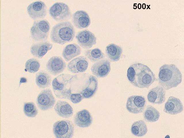 500x Papanicolaou staining