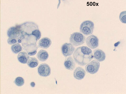 500x Papanicolaou staining