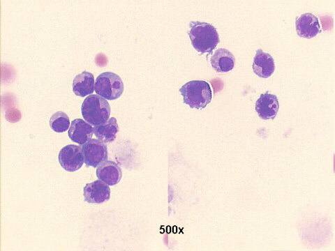 500x M-G-G staining