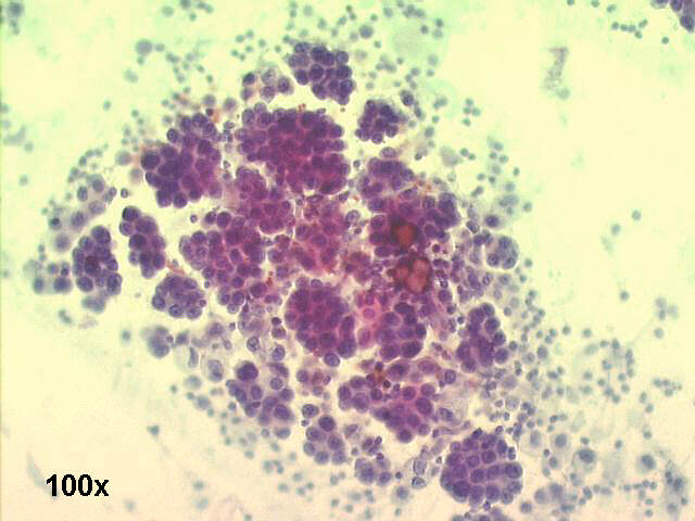 100x Papanicolaou staining