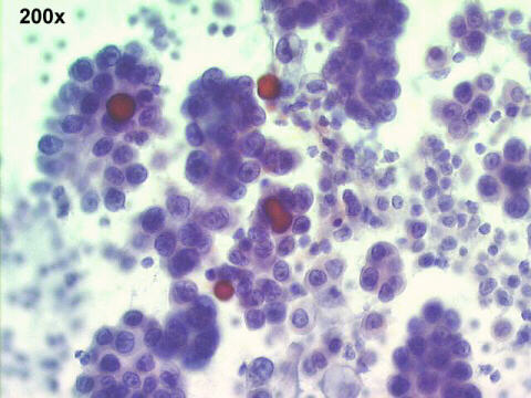 200x Papanicolaou staining