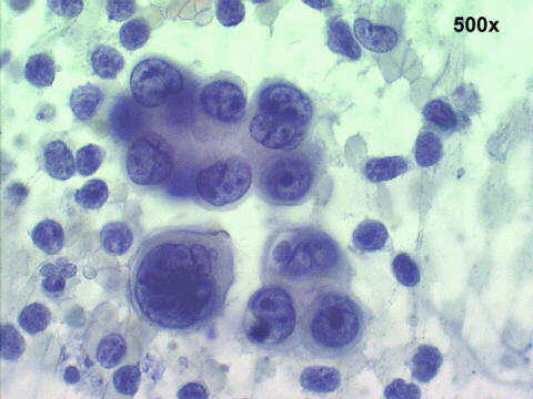 500x Papanicolaou staining