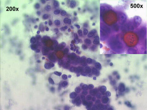 200x Papanicolaou staining
